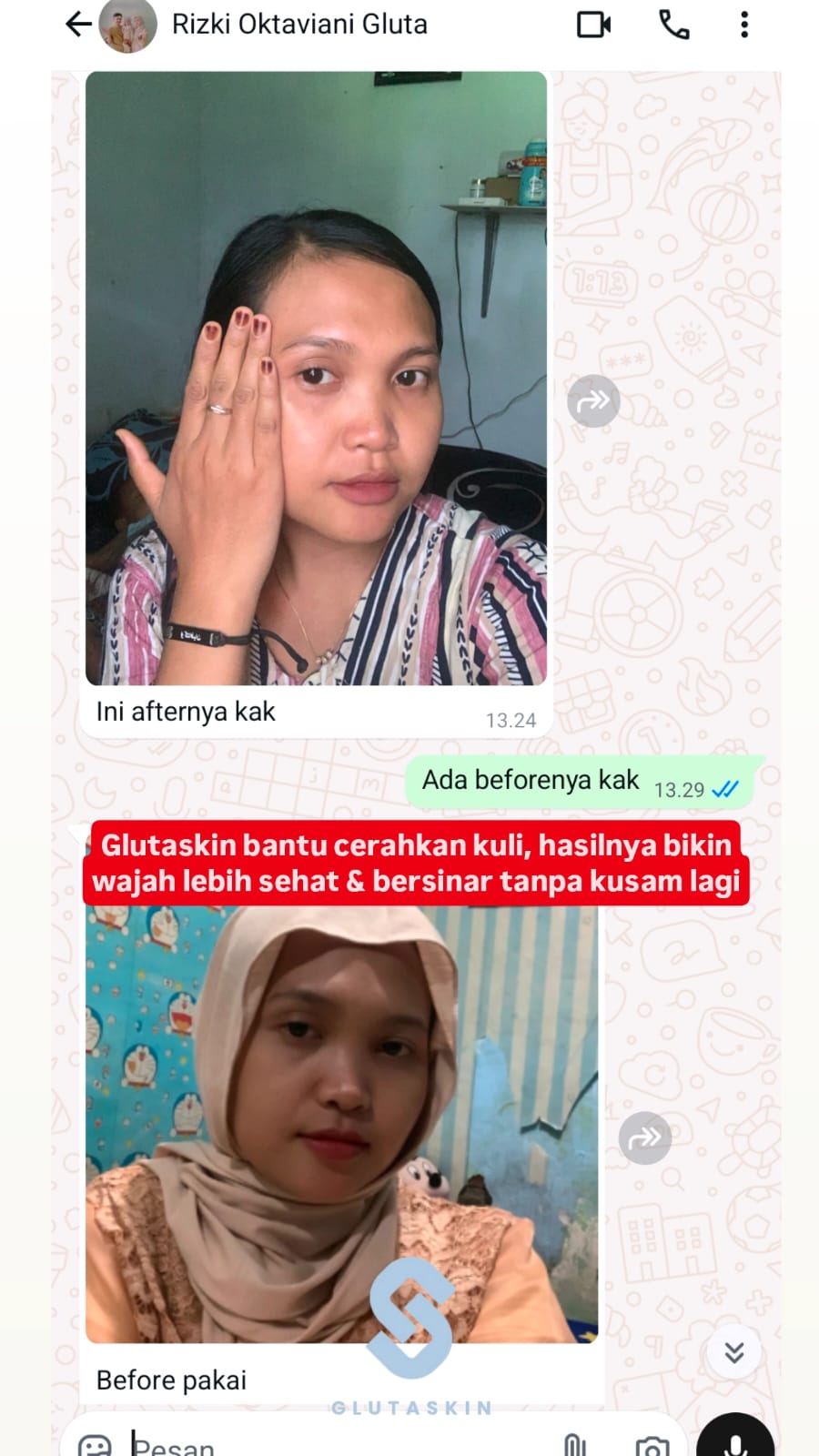 Testimoni Real Luxskin Gluta 14
