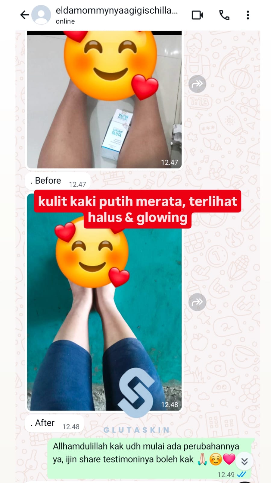 Testimoni Real Luxskin Gluta 15